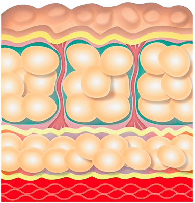 Illustrazione tessuto infiammato